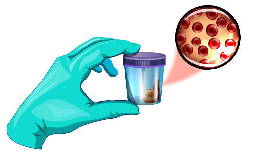 FAECAL OCCULT BLOOD