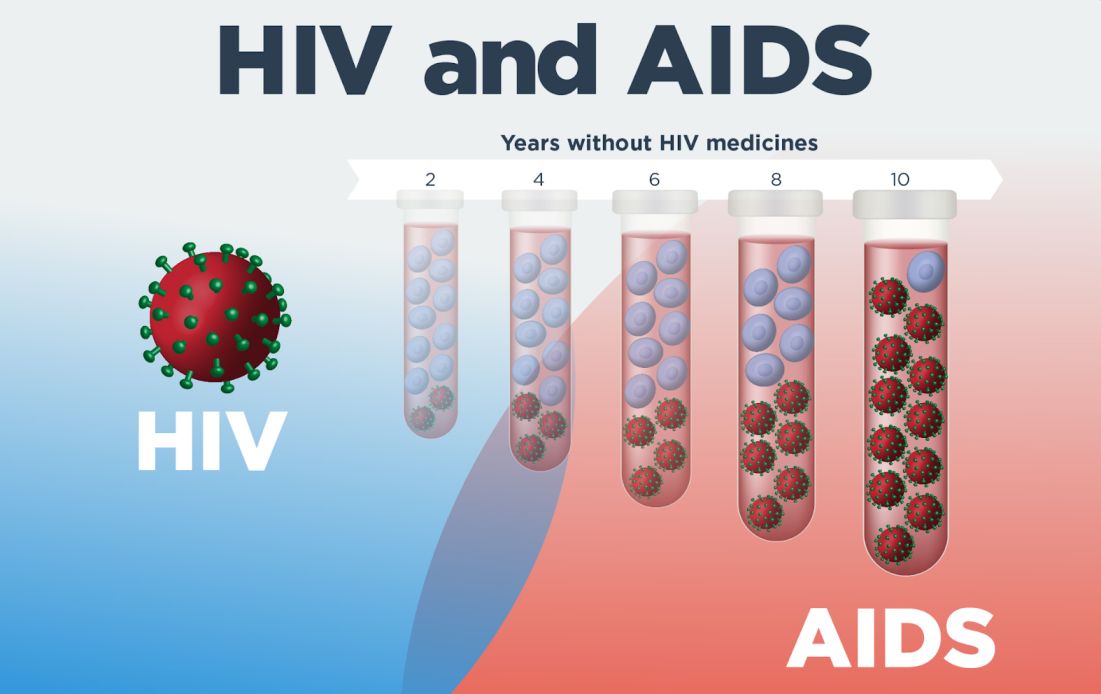 HIV and AIDS