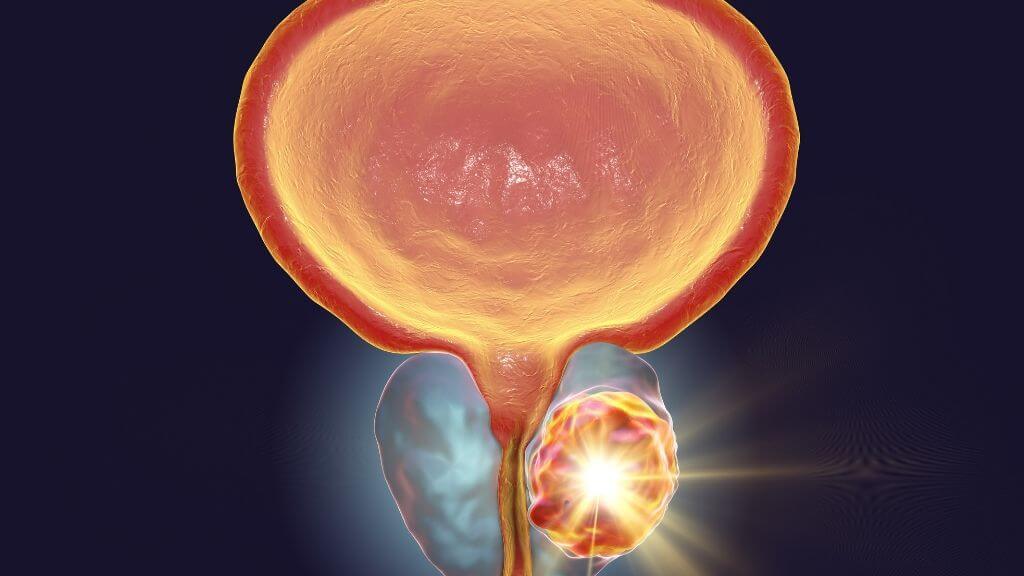 Illustration of a prostate gland