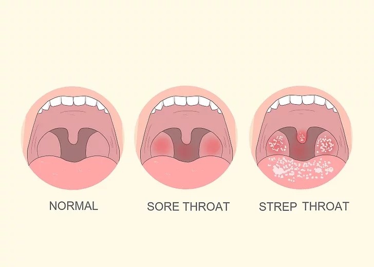 Strep A rapid test kit