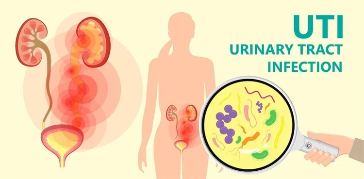 urinary tract infection