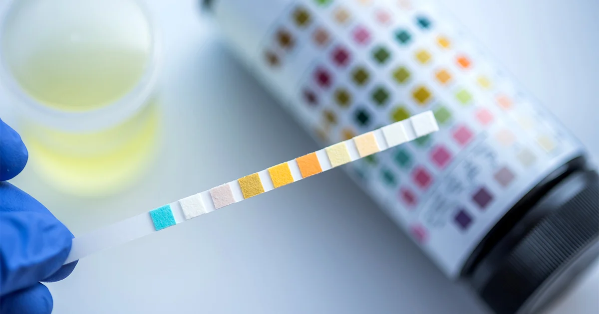 At-Home Drug Test Kits